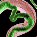 Protect Yourself from Potential Diseases and Parasites