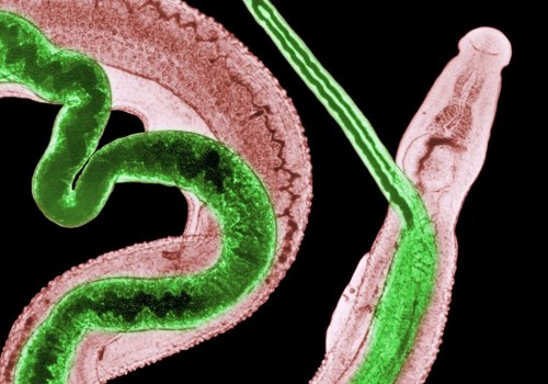 Protect Yourself from Potential Diseases and Parasites